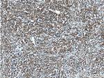 BCL6 Antibody in Immunohistochemistry (Paraffin) (IHC (P))