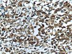 BCL6 Antibody in Immunohistochemistry (Paraffin) (IHC (P))