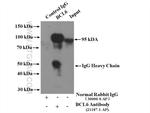 BCL6 Antibody in Immunoprecipitation (IP)