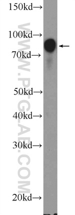 BCL6 Antibody in Western Blot (WB)