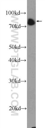 BCL6 Antibody in Western Blot (WB)