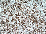 HSPA4 Antibody in Immunohistochemistry (Paraffin) (IHC (P))