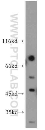 ADAD2 Antibody in Western Blot (WB)