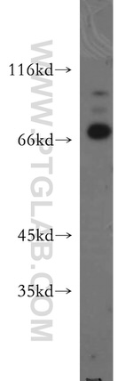E2A Antibody in Western Blot (WB)