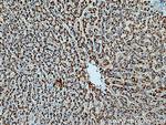 Catalase Antibody in Immunohistochemistry (Paraffin) (IHC (P))