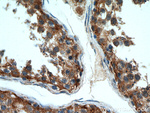 TTC39A Antibody in Immunohistochemistry (Paraffin) (IHC (P))