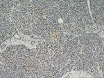 RBM39 Antibody in Immunohistochemistry (Paraffin) (IHC (P))