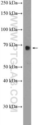 RBM39 Antibody in Western Blot (WB)