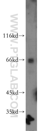 RBM39 Antibody in Western Blot (WB)