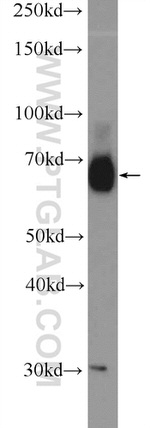 RBM39 Antibody in Western Blot (WB)