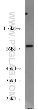 SASS6 Antibody in Western Blot (WB)
