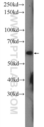 CHRNA7 Antibody in Western Blot (WB)