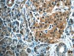 ALDH1L2 Antibody in Immunohistochemistry (Paraffin) (IHC (P))