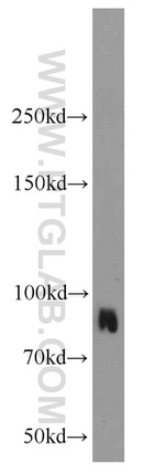 ALDH1L2 Antibody in Western Blot (WB)