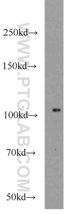 ALDH1L2 Antibody in Western Blot (WB)