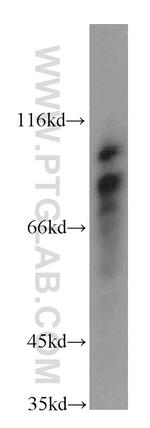 MYLK3 Antibody in Western Blot (WB)
