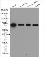 FAM134B Antibody in Western Blot (WB)