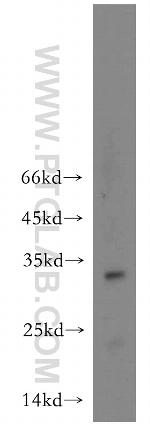 OGFOD2 Antibody in Western Blot (WB)
