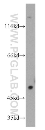 PFTK1 Antibody in Western Blot (WB)