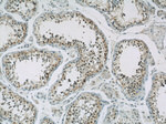 GPBP1 Antibody in Immunohistochemistry (Paraffin) (IHC (P))