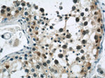 GPBP1 Antibody in Immunohistochemistry (Paraffin) (IHC (P))