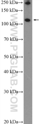 RNF20 Antibody in Western Blot (WB)