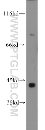 SLC5A3 Antibody in Western Blot (WB)