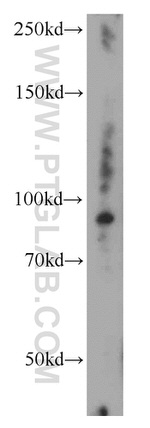 UNC45B Antibody in Western Blot (WB)