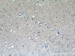 RAB3GAP1 Antibody in Immunohistochemistry (Paraffin) (IHC (P))