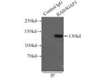 RAB3GAP1 Antibody in Immunoprecipitation (IP)