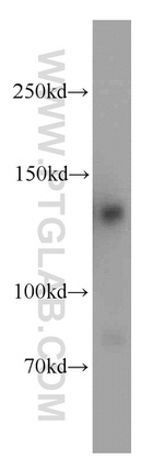 RAB3GAP1 Antibody in Western Blot (WB)