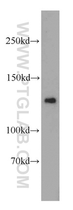 RAB3GAP1 Antibody in Western Blot (WB)