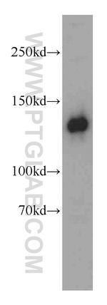 RAB3GAP1 Antibody in Western Blot (WB)