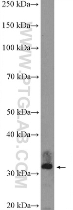 SIP1 Antibody in Western Blot (WB)