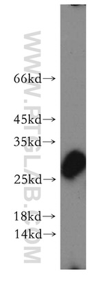 NANOS3 Antibody in Western Blot (WB)