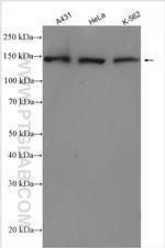 SMC1A Antibody in Western Blot (WB)