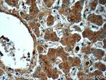 NEDD4 Antibody in Immunohistochemistry (Paraffin) (IHC (P))