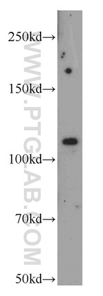 NEDD4 Antibody in Western Blot (WB)