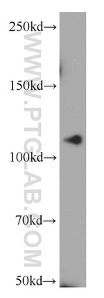 NEDD4 Antibody in Western Blot (WB)