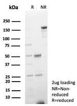 Heart Fatty Acid Binding Protein (H-FABP)/FABP3 Antibody in SDS-PAGE (SDS-PAGE)
