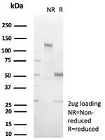 Heart Fatty Acid Binding Protein (H-FABP)/FABP3 Antibody in SDS-PAGE (SDS-PAGE)