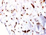 FABP5 Antibody in Immunohistochemistry (Paraffin) (IHC (P))