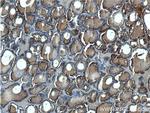 Thyroglobulin Antibody in Immunohistochemistry (Paraffin) (IHC (P))