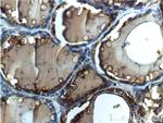 Thyroglobulin Antibody in Immunohistochemistry (Paraffin) (IHC (P))