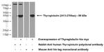 Thyroglobulin Antibody in Western Blot (WB)