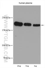 pregnancy zone protein Antibody in Western Blot (WB)