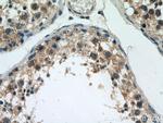 HIGD1A Antibody in Immunohistochemistry (Paraffin) (IHC (P))