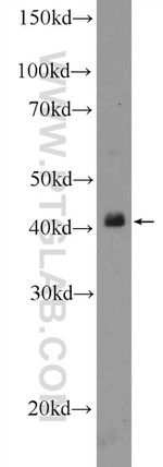 TTF1/NKX2-1 Antibody in Western Blot (WB)