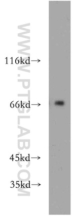 POLA2 Antibody in Western Blot (WB)