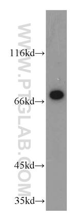 POLA2 Antibody in Western Blot (WB)